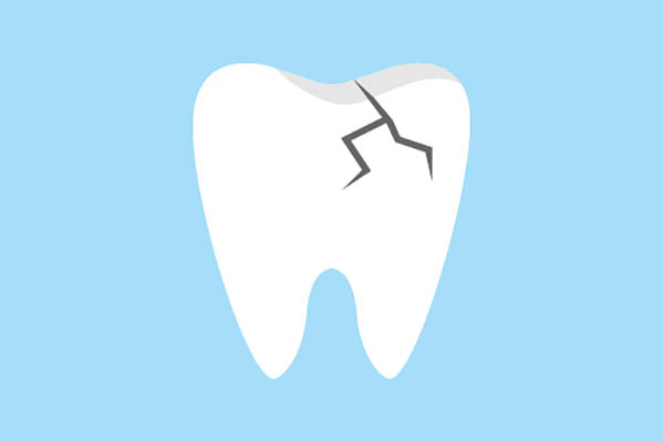 Ask an Implant Dentist About Replacing a Damaged Tooth from Gledhill Dental in Kennewick, WA