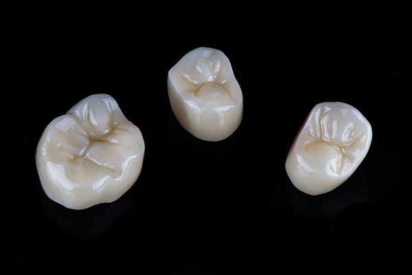 A Comparison of Dental Crown Materials from Gledhill Dental in Kennewick, WA