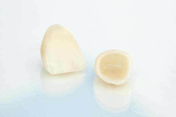 Dental Crowns Kennewick, WA