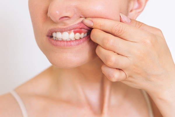 Tips For Preventing Gum Disease