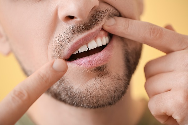 How Is Gum Disease Treated?
