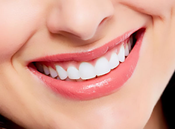 How Dental Veneers Can Restore Damaged Teeth