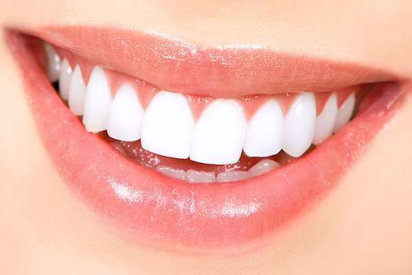 How Long Does Teeth Whitening Take from Gledhill Dental in Kennewick, WA