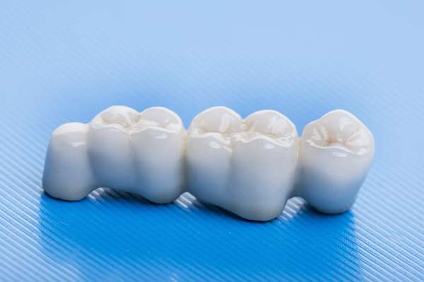How Many Teeth Can Dental Bridges Replace from Gledhill Dental in Kennewick, WA