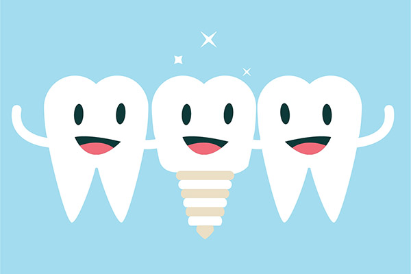 Implant Dentistry Aftercare FAQs from Gledhill Dental in Kennewick, WA