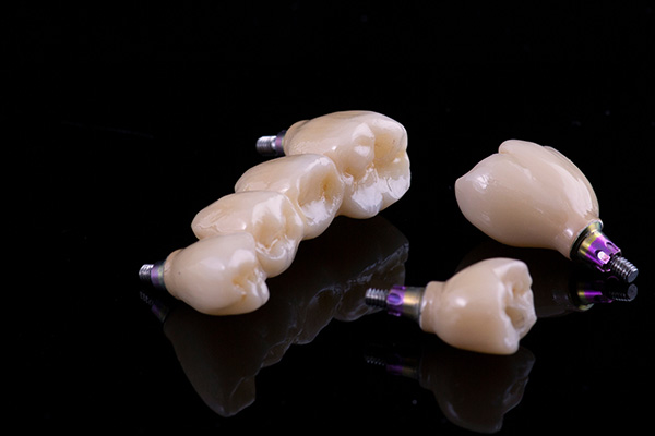 Implant Dentistry Options for Multiple Missing Teeth from Gledhill Dental in Kennewick, WA