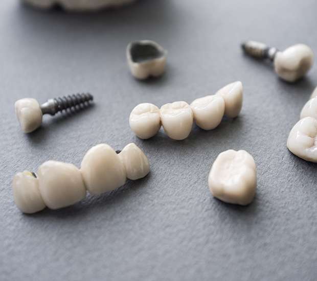 Kennewick The Difference Between Dental Implants and Mini Dental Implants