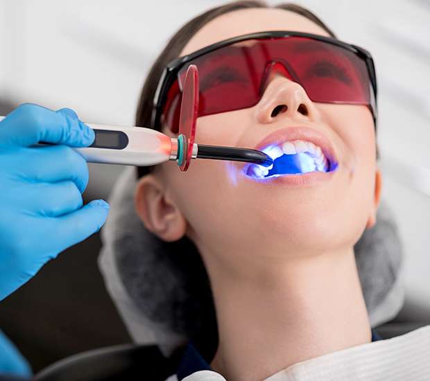 Kennewick Professional Teeth Whitening