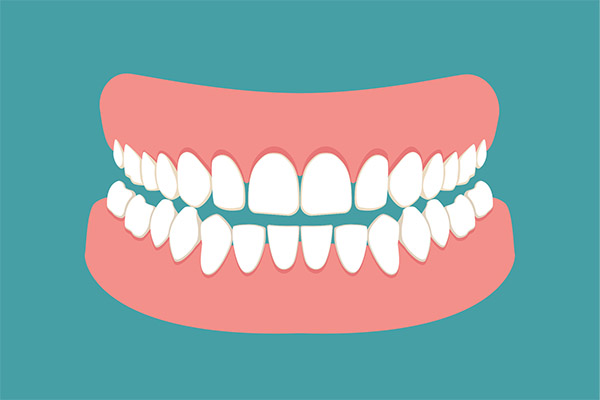 The FAQ’s Of Denture Care
